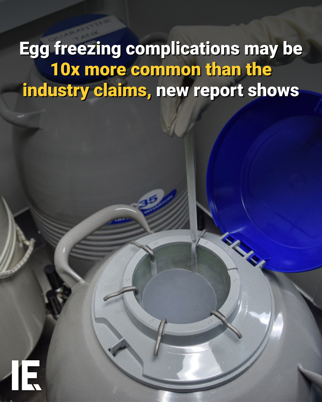 Egg Freezing Complications More Common Than Claimed