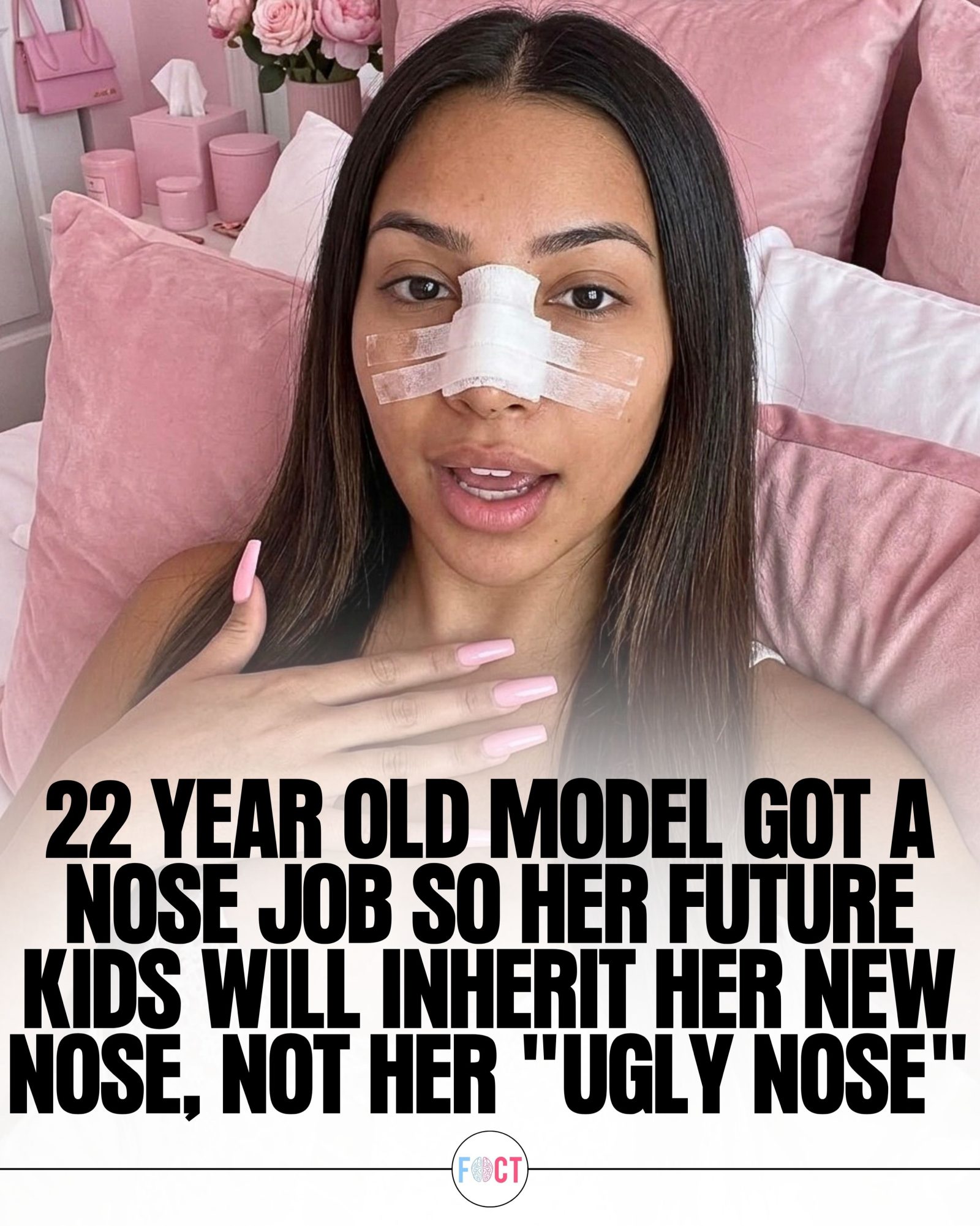 Model's Nose Job: A Gift for Future Generations
