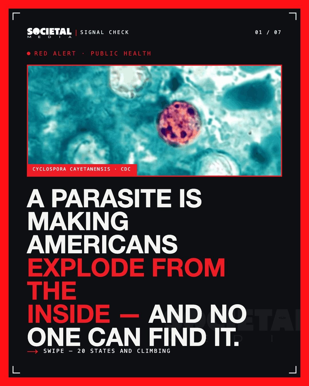 Cyclospora Outbreak: 145 Infected Across 20 States, Source Unknown