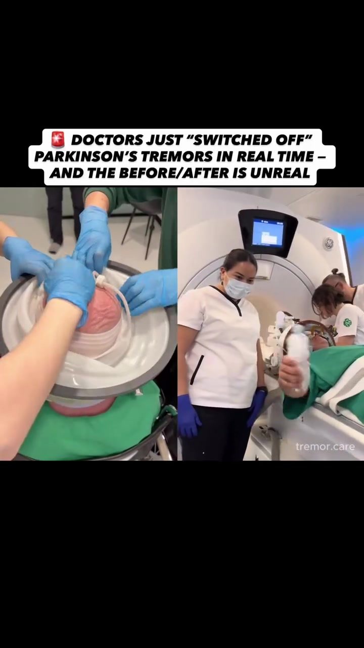 Revolutionary Real-Time Tremor Reduction with MR-Guided Focused Ultrasound