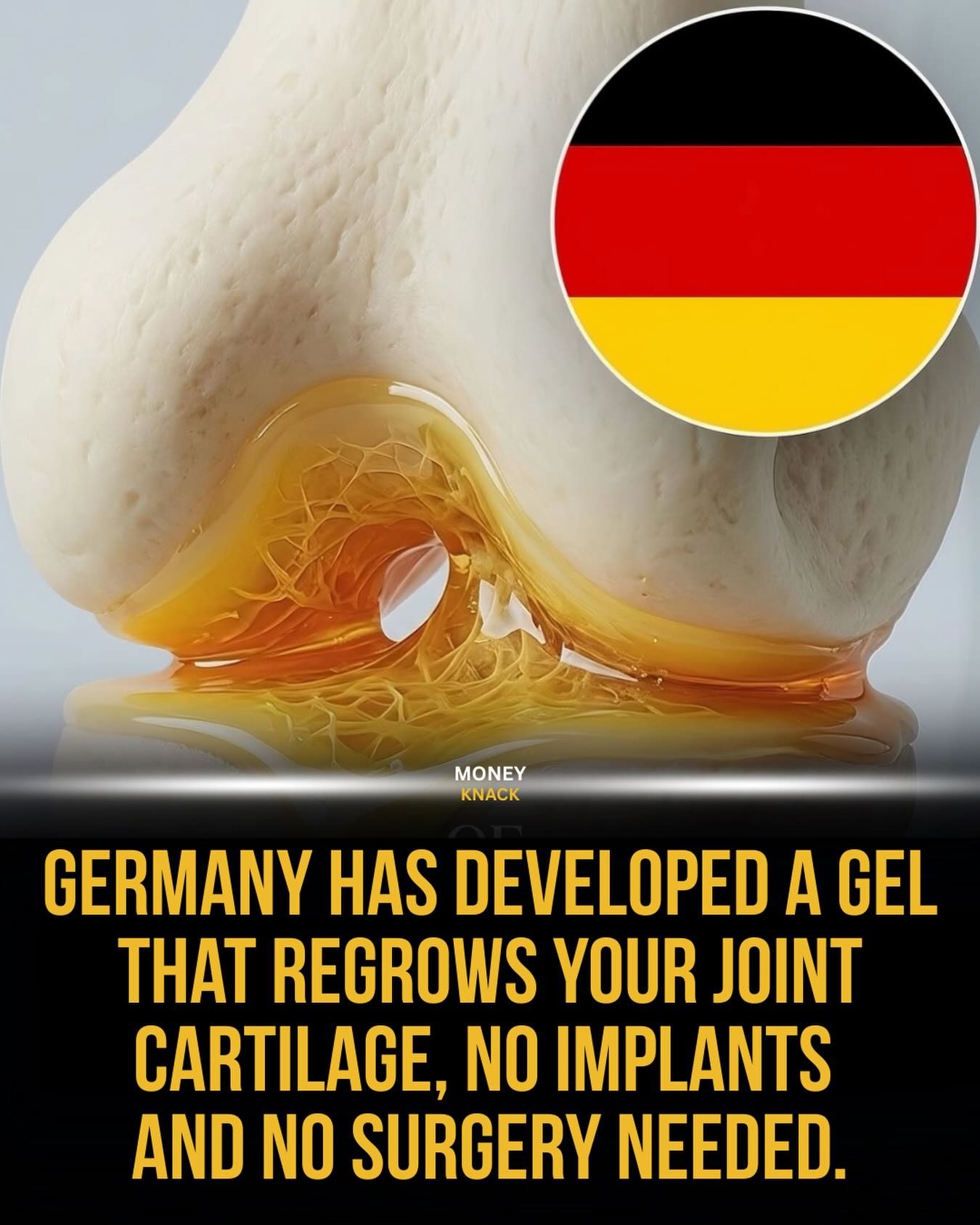 **German Gel Promises Joint Cartilage Regrowth Without Surgery**