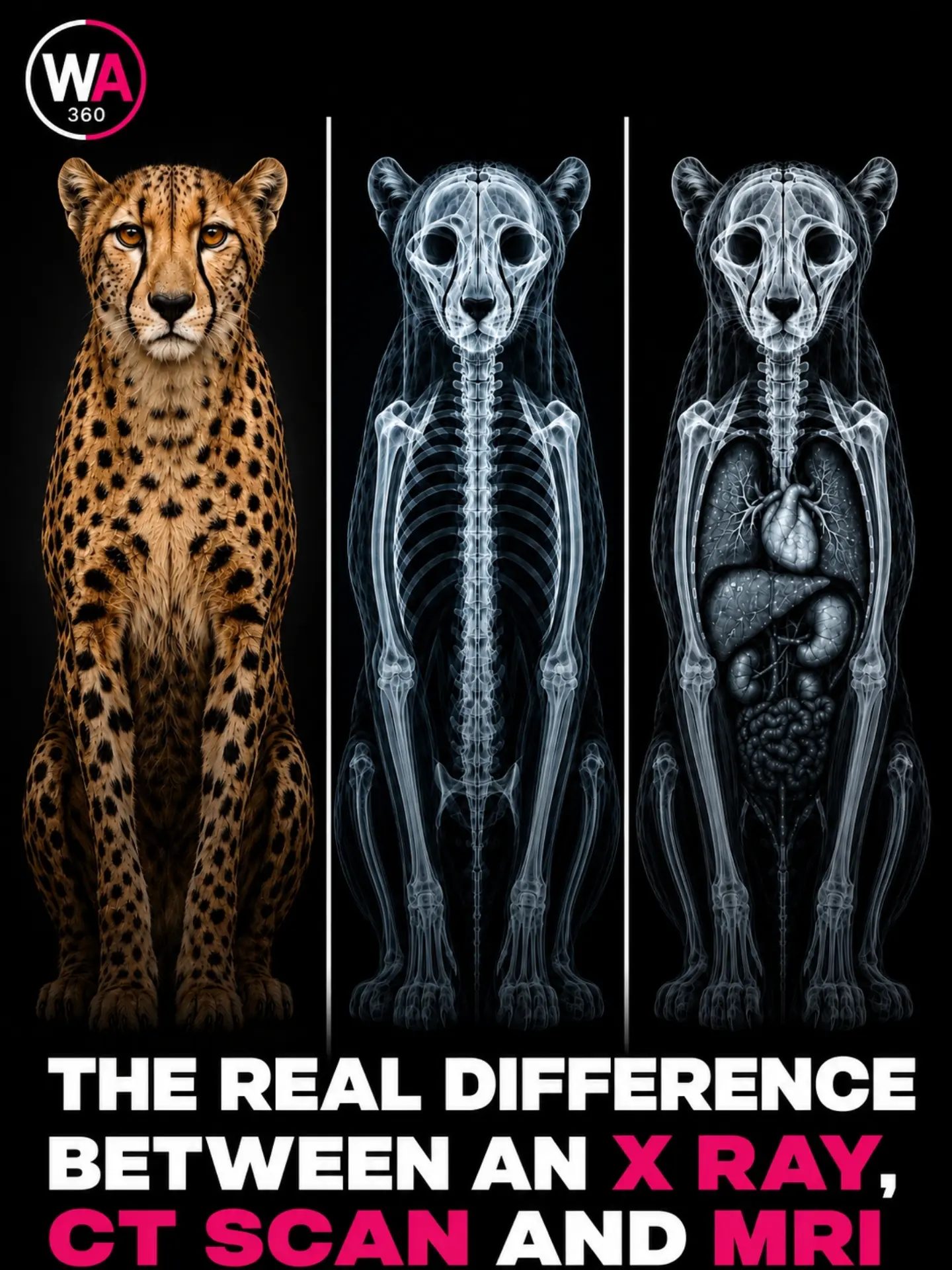 Understand the Differences: X-Ray, CT Scan, and MRI