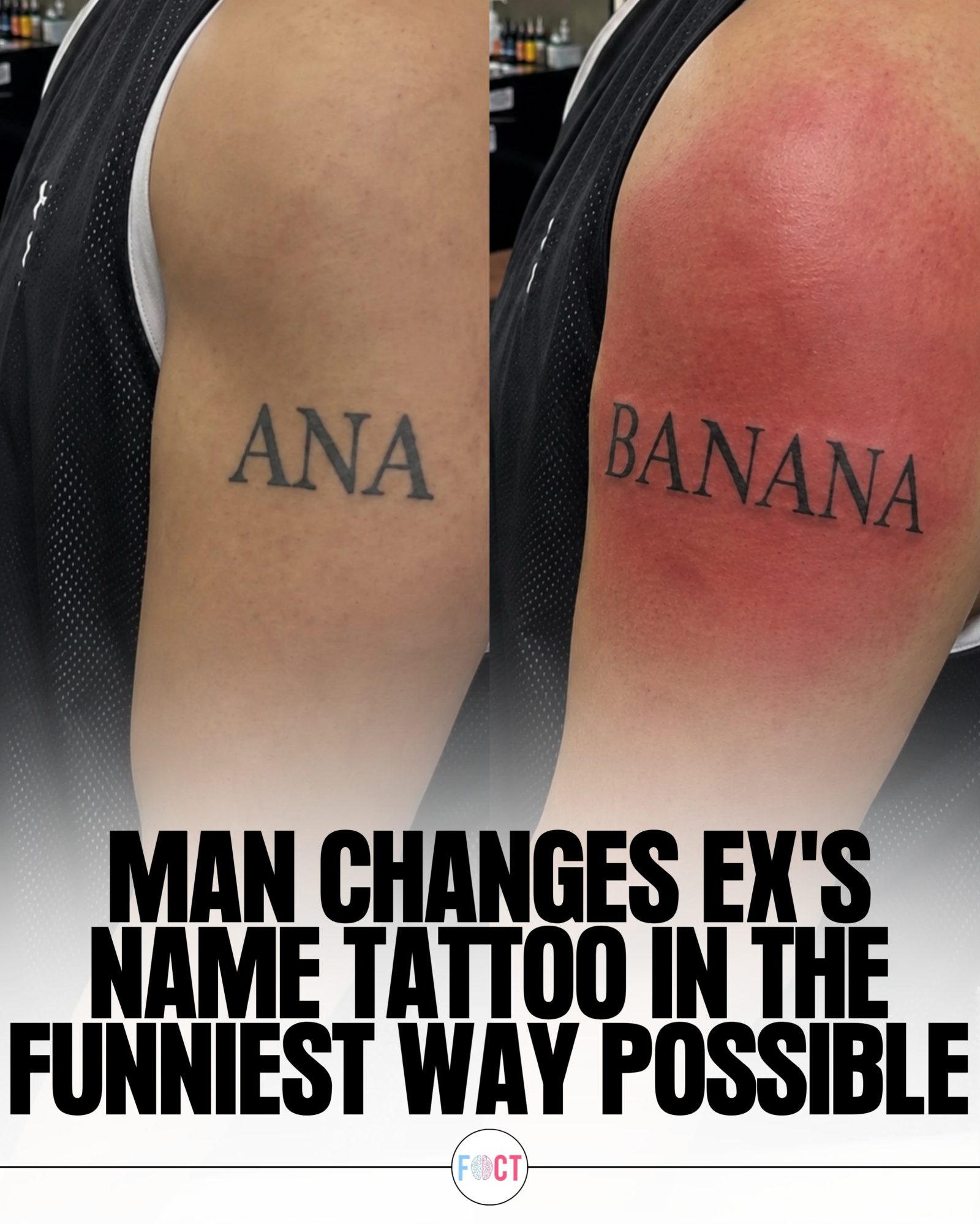 Man Turns Ex's Name Tattoo into a Banana