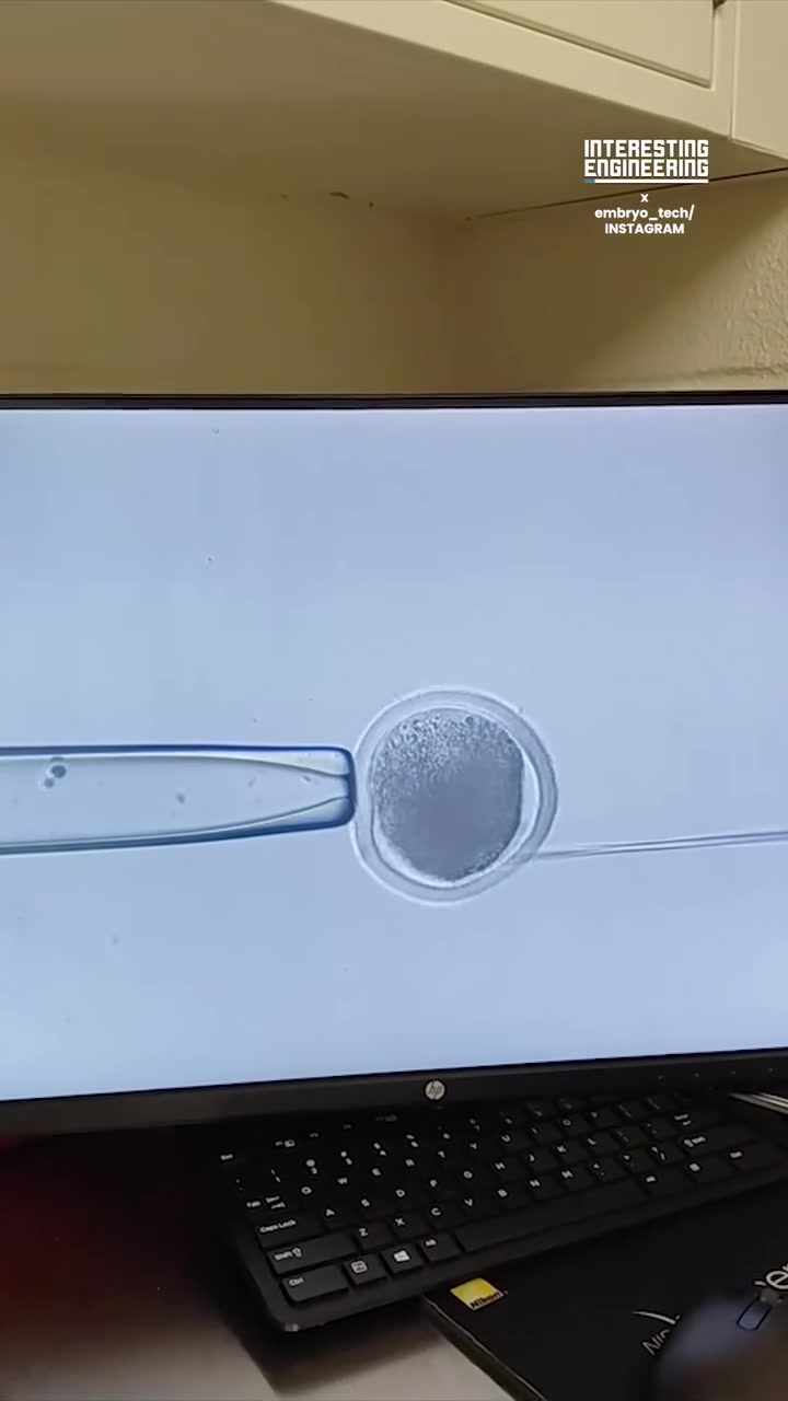 Embryo Development: A Microscopic Journey