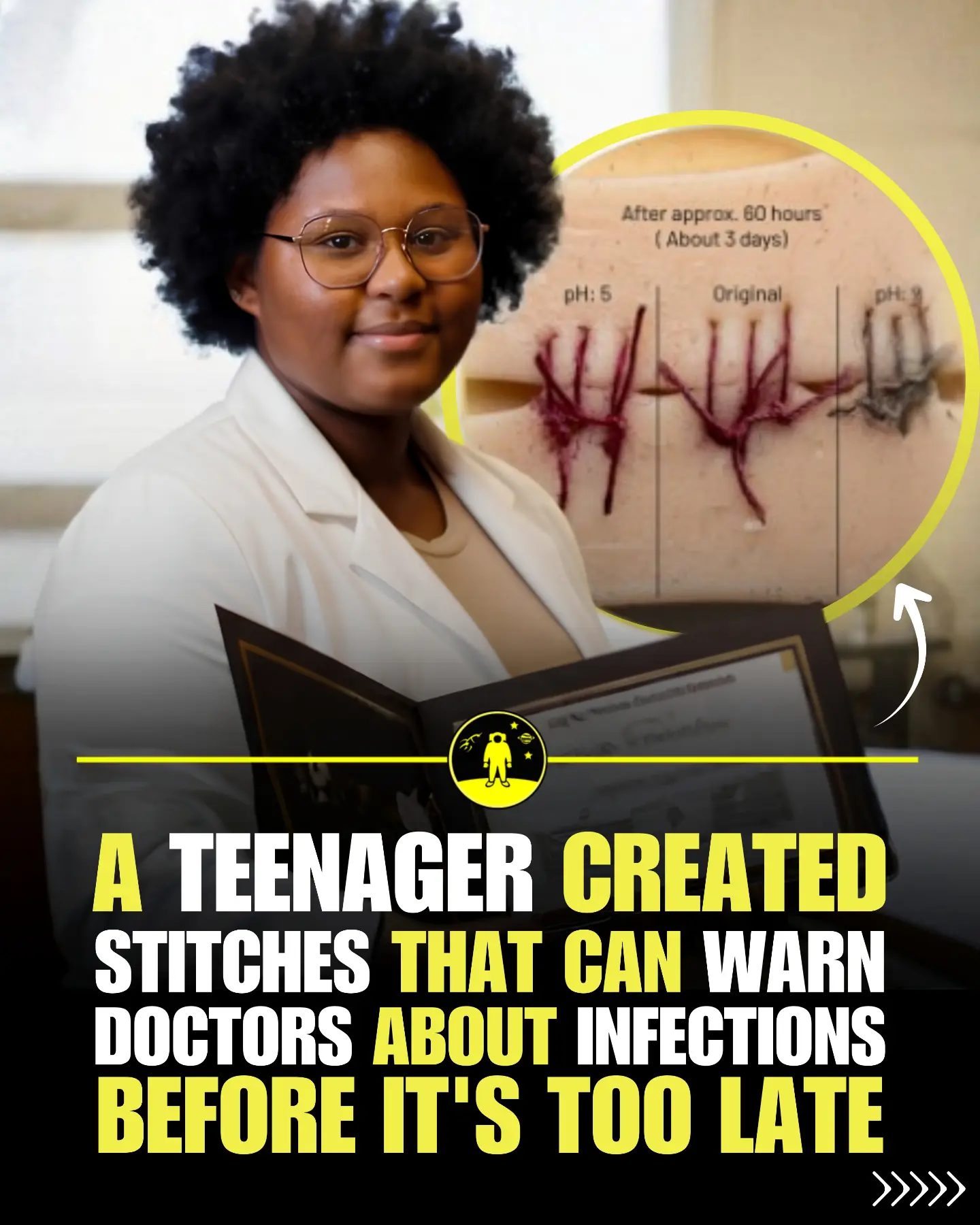 Dasia Taylor's Color-Changing Infection-Detecting Sutures