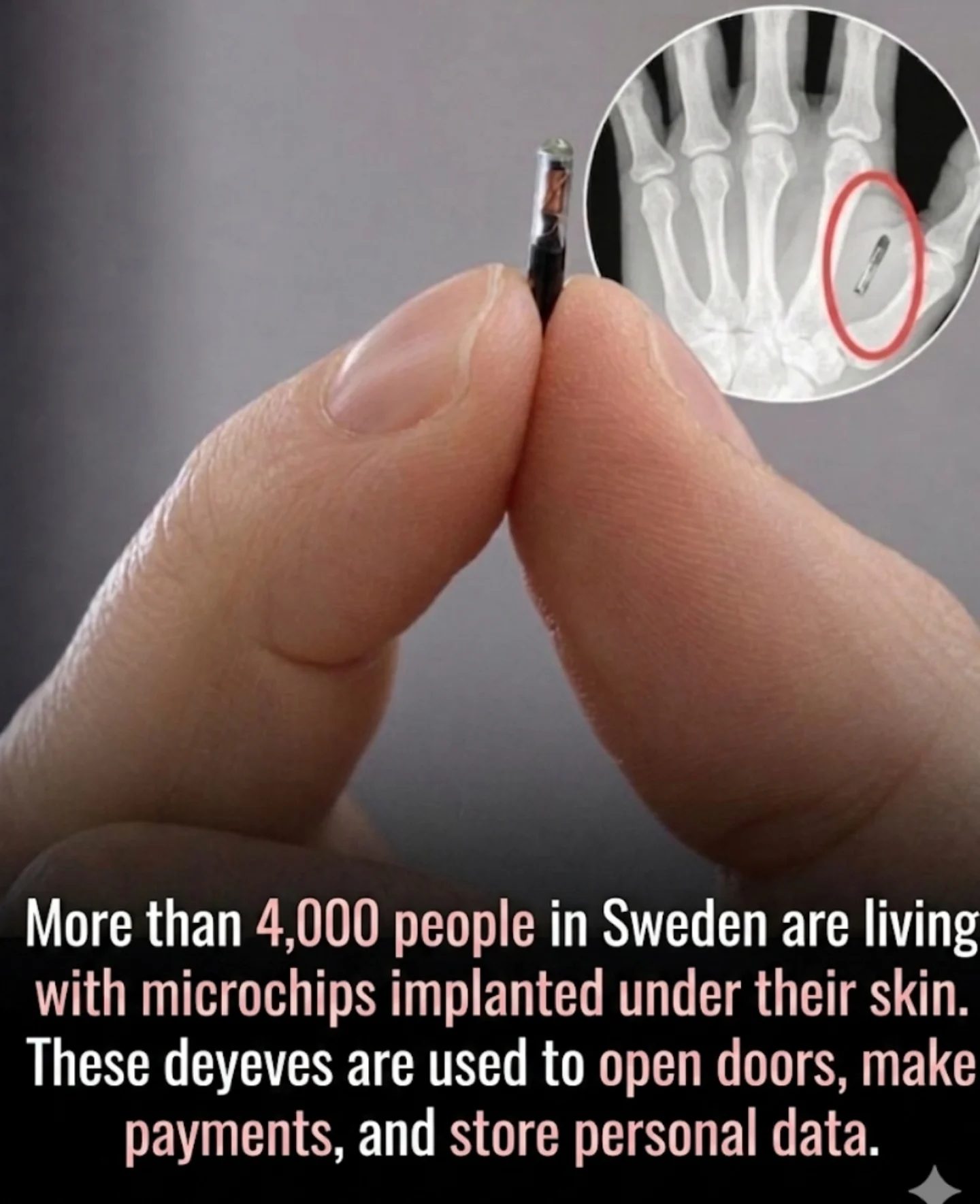 Microchip Implants: The Swedish Biohacking Trend