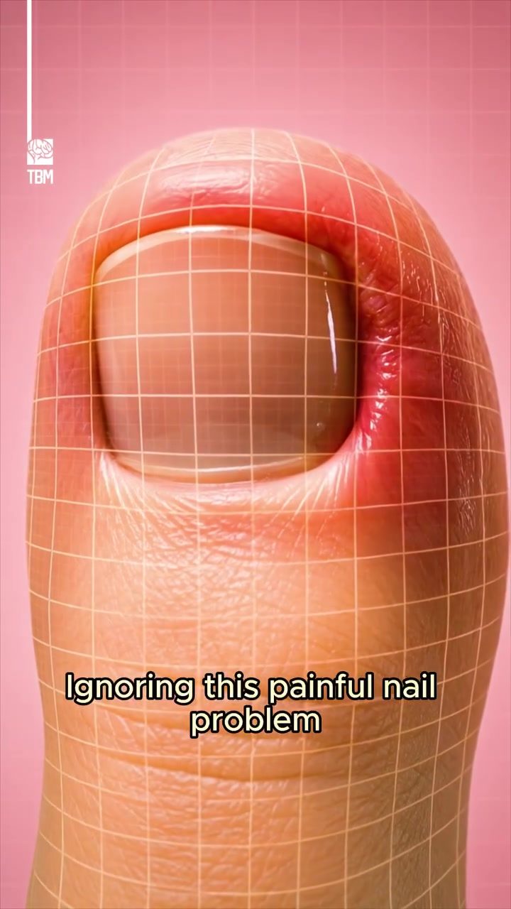 **Causes and Treatments for Ingrown Toenails**