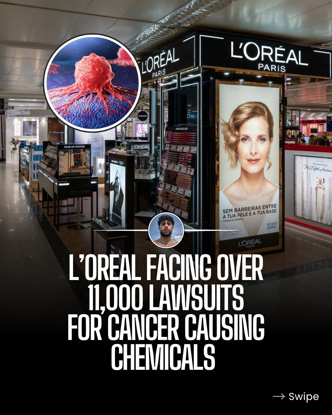 L'Oréal Hair Relaxer Cancer Lawsuits: Over 11,000 Claims