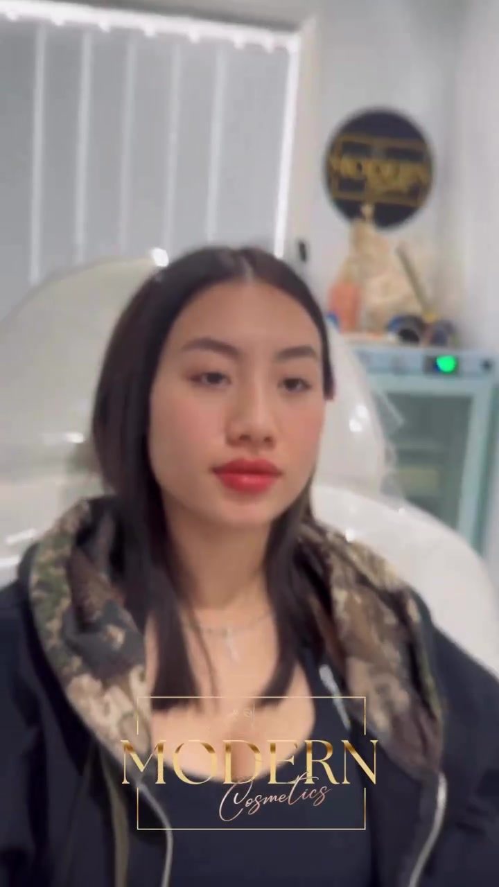 Discover the Lip Filler Procedure at Modern Cosmetics