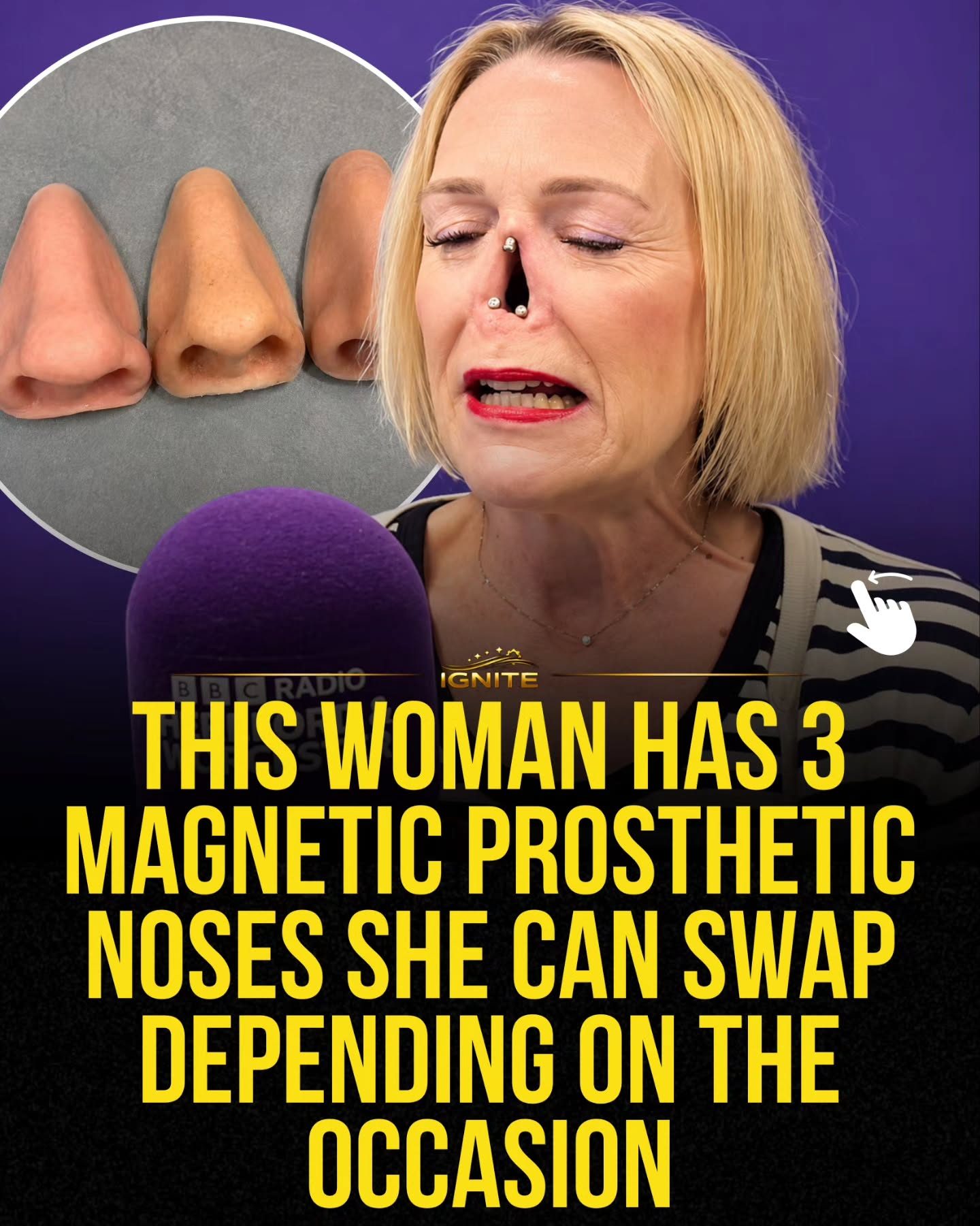 How Magnetic Prosthetic Noses Changed One Woman's Life