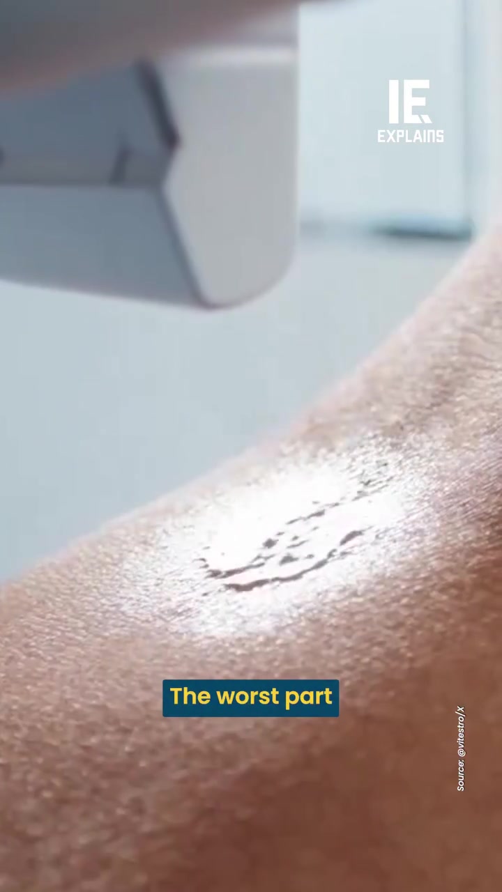 Viestro Blood Draw Device: FDA Cleared, Autonomous