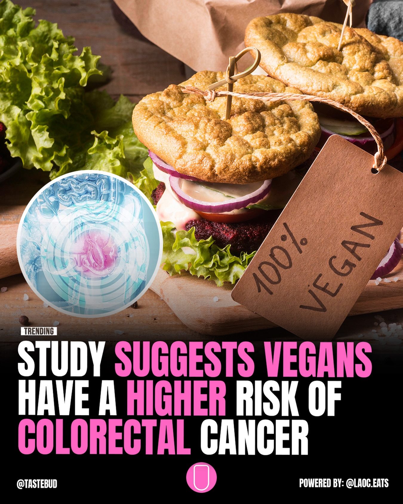 ### Vegan Diet and Colorectal Cancer Risk

(Vegan Diet and Colorectal Cancer Risk 57 characters)