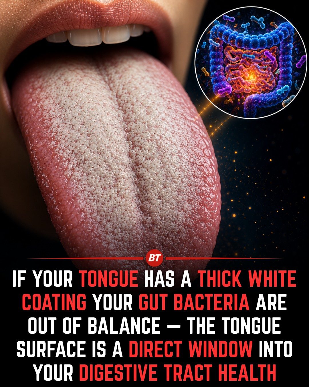 How Your Tongue Reveals Gut Health