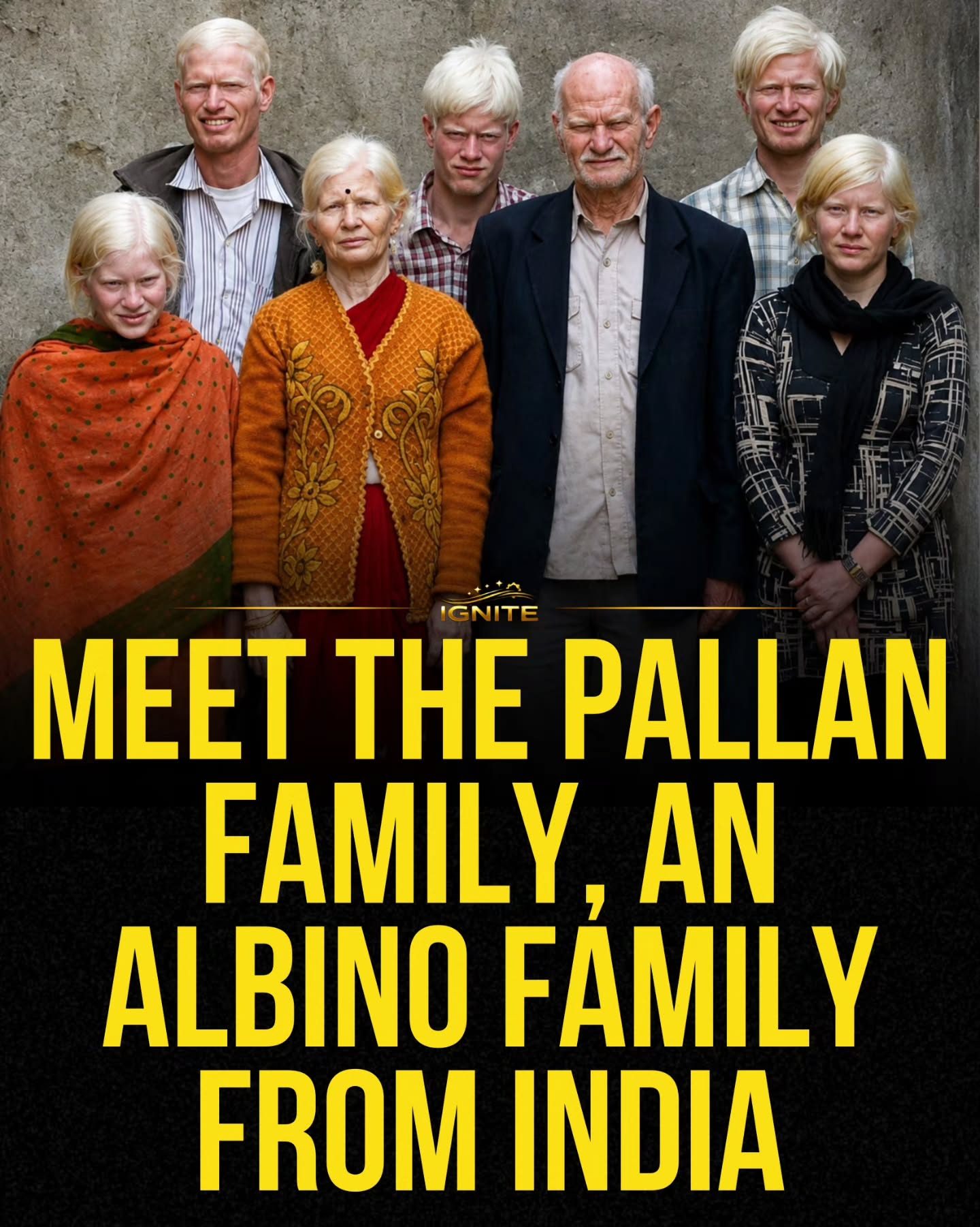 Meet the Pallan Family: An Inspiring Albinism Portrait