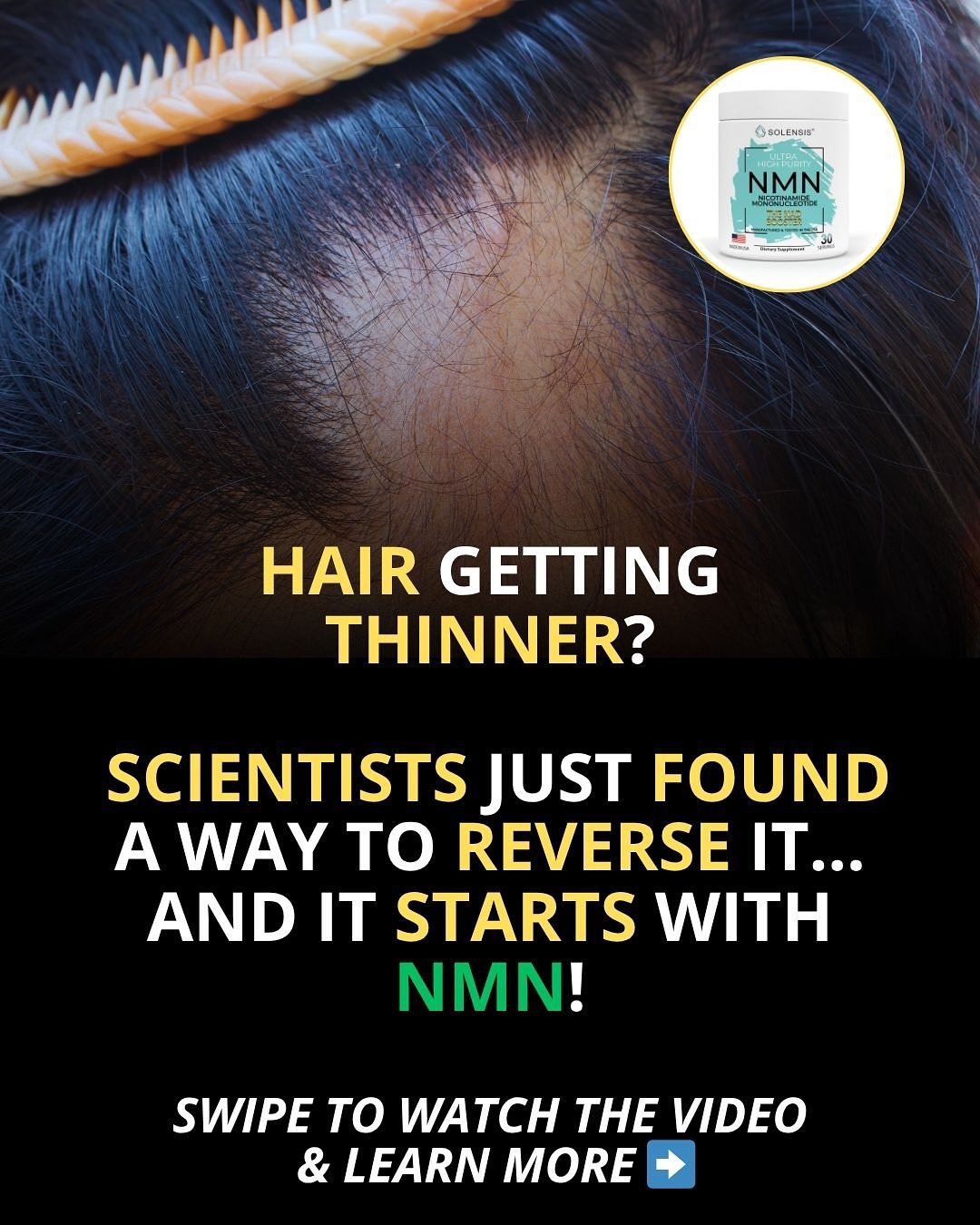 Can NMN Reverse Hair Thinning?