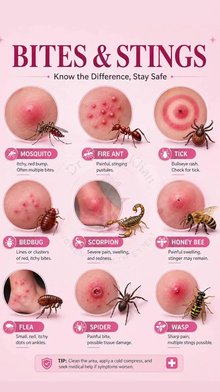 How to Identify Common Insect Bites and Stings