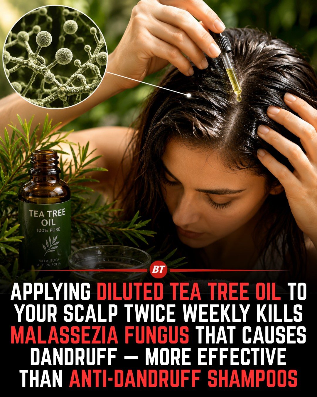 Tea Tree Oil: A Natural Remedy for Dandruff Treatment