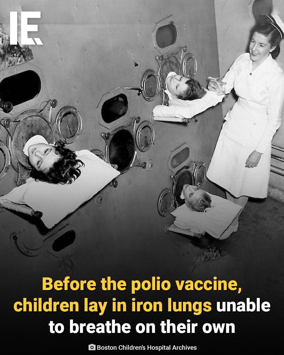 The Evolution of Polio Treatment: Iron Lungs Before Vaccines
