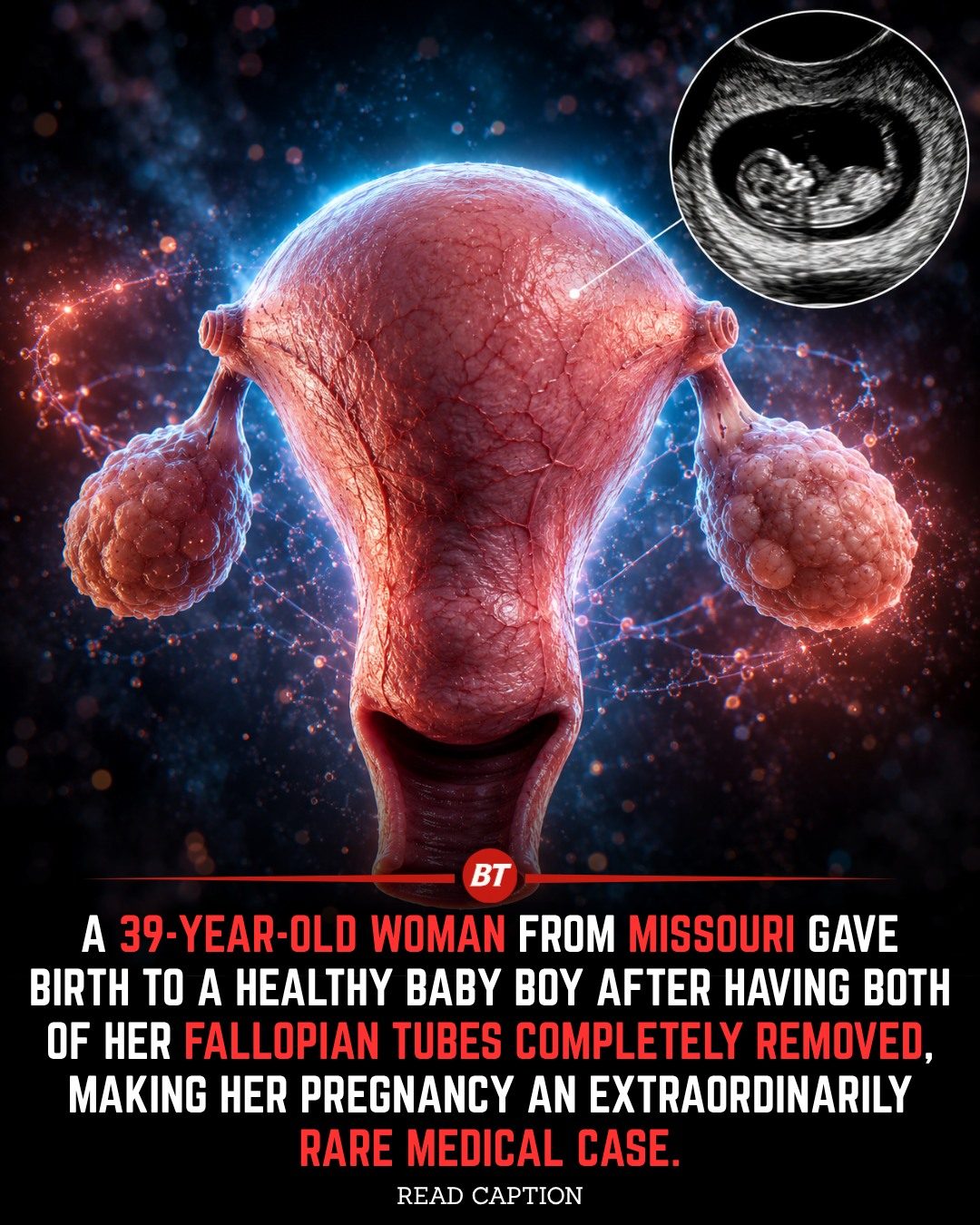 Extraordinary Pregnancy: Missouri Woman Gives Birth After Tube Removal
