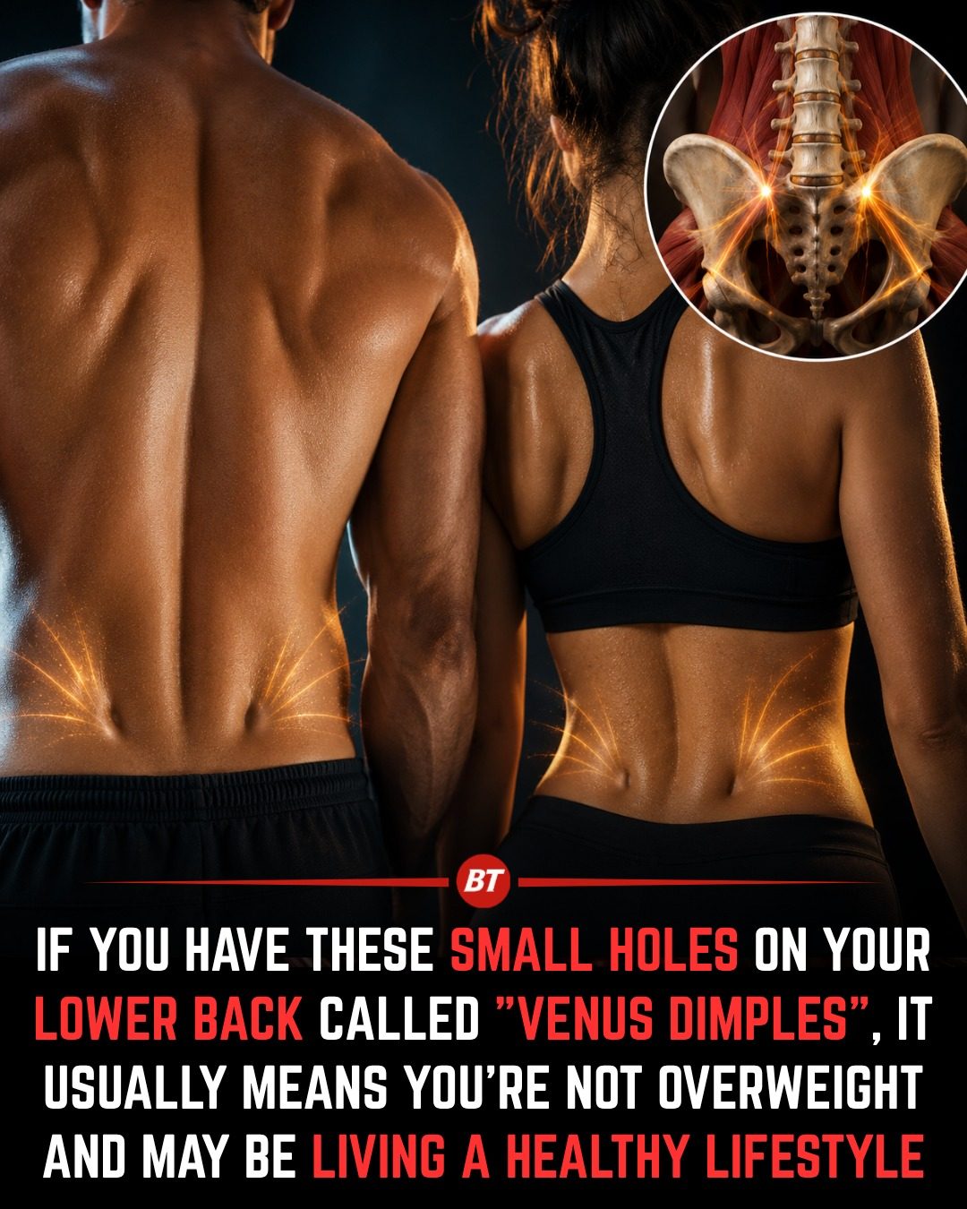Venus Dimples: What They Are and What They Mean