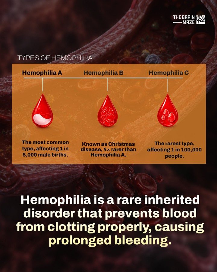 Learn About the Three Types of Hemophilia