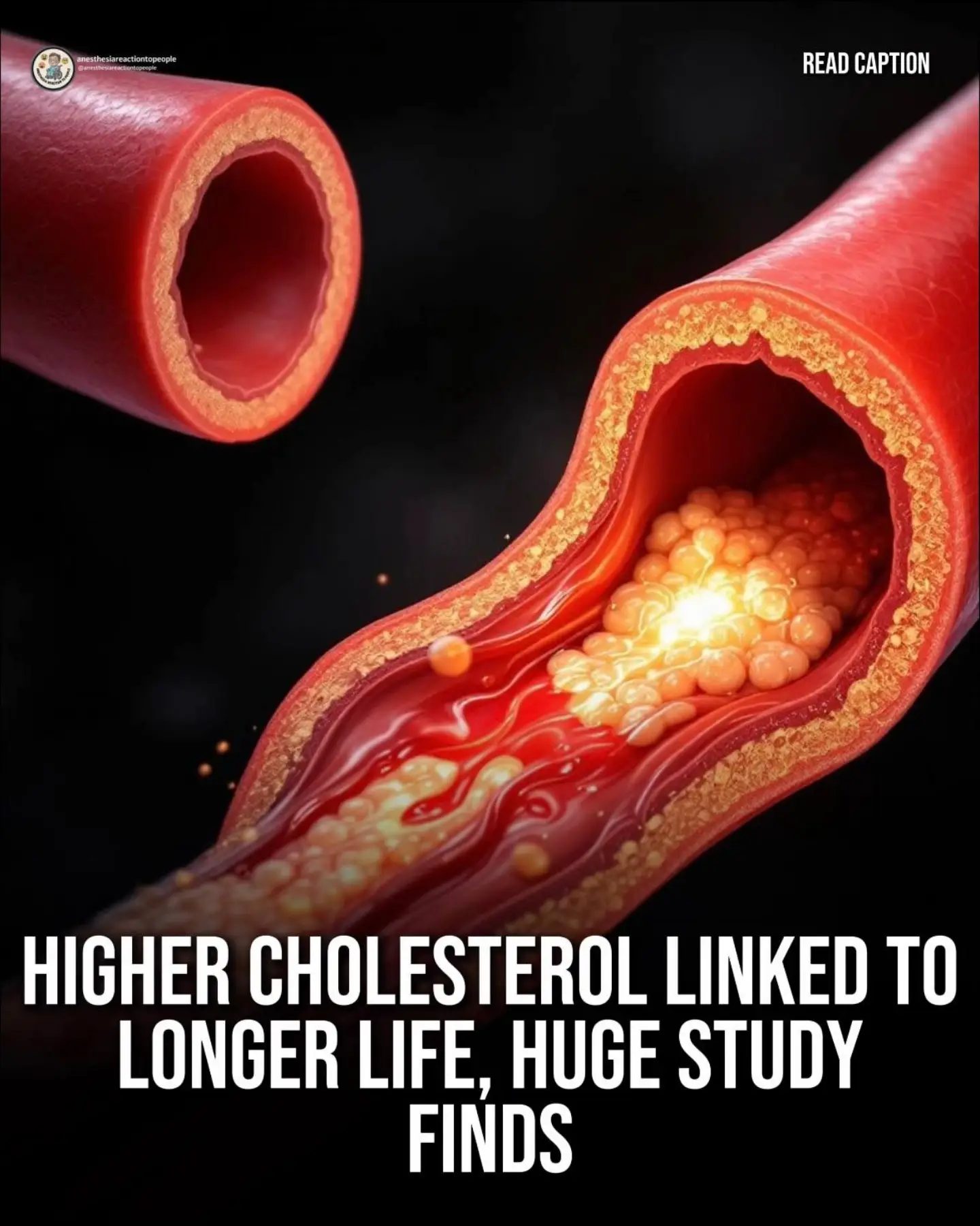 **Higher LDL Cholesterol in Seniors May Link to Increased Longevity**