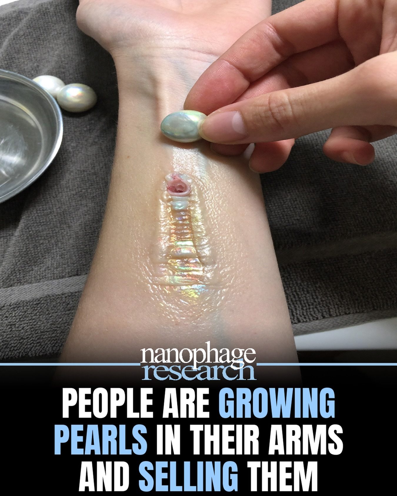 Growing Pearls in Arms: Nanophage's Unique Body Modification