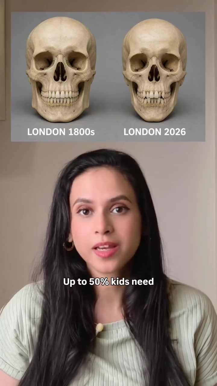 The Impact of Diet on Children's Jaw Development