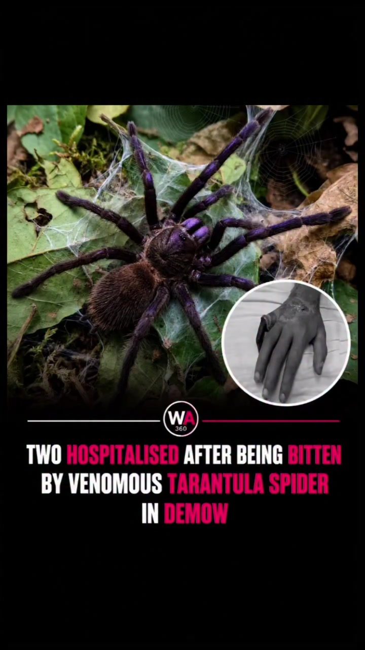 Tarantula Bite: First Aid & Facts About These Giant Spiders
