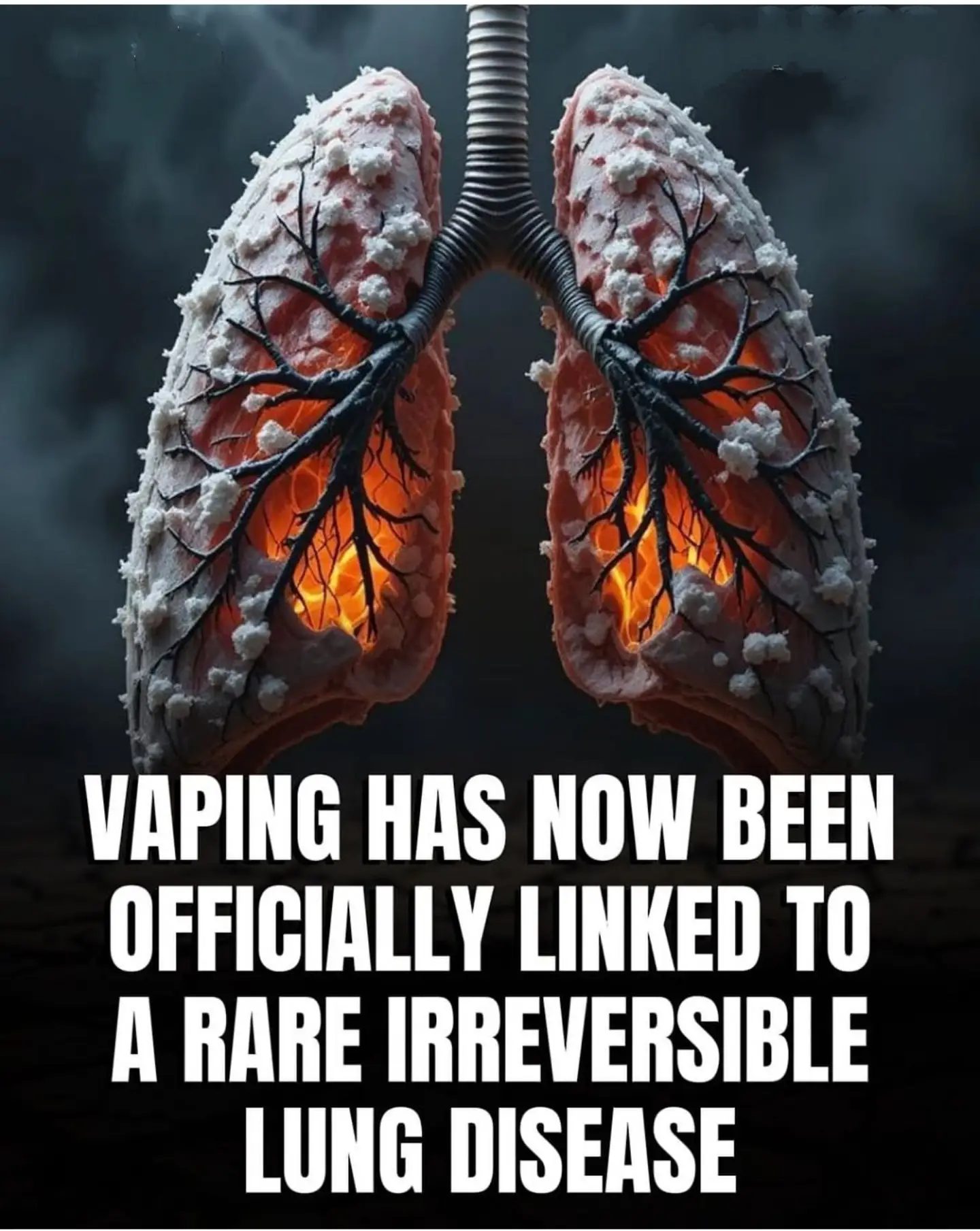 The Dangers of Vaping: Rare, Irreversible Lung Disease
