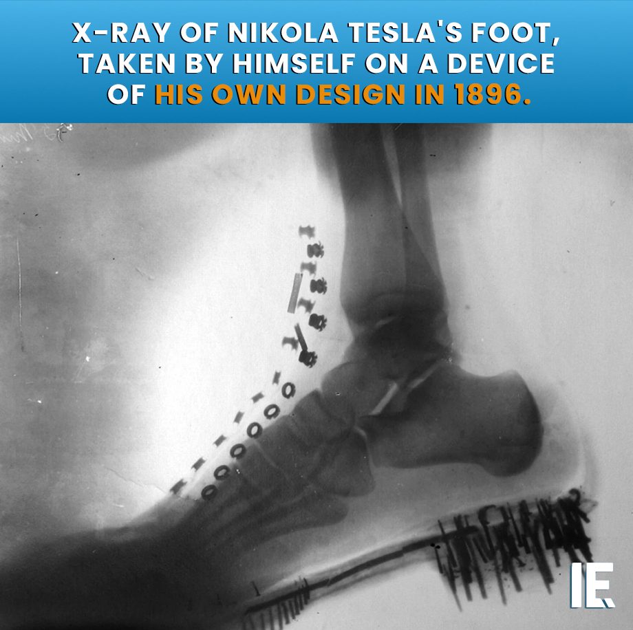 Tesla's Pioneering X-ray Footage from 1896