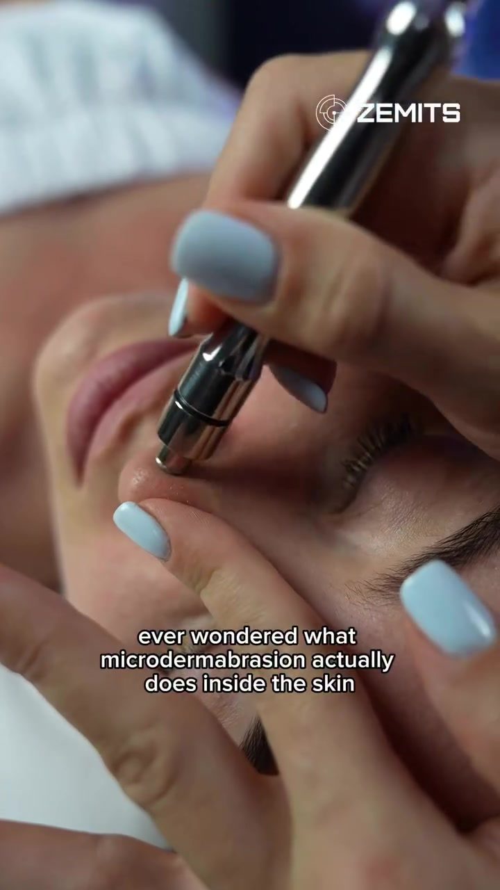 How the ZEMITS Microdermabrasion Device Improves Skin Texture.