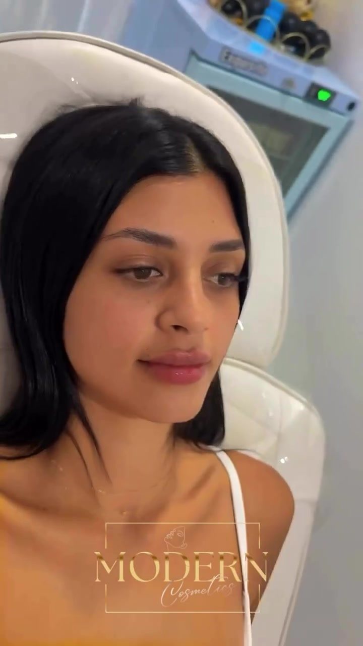 Personalised Lip Filler Consultations at Modern Cosmetix