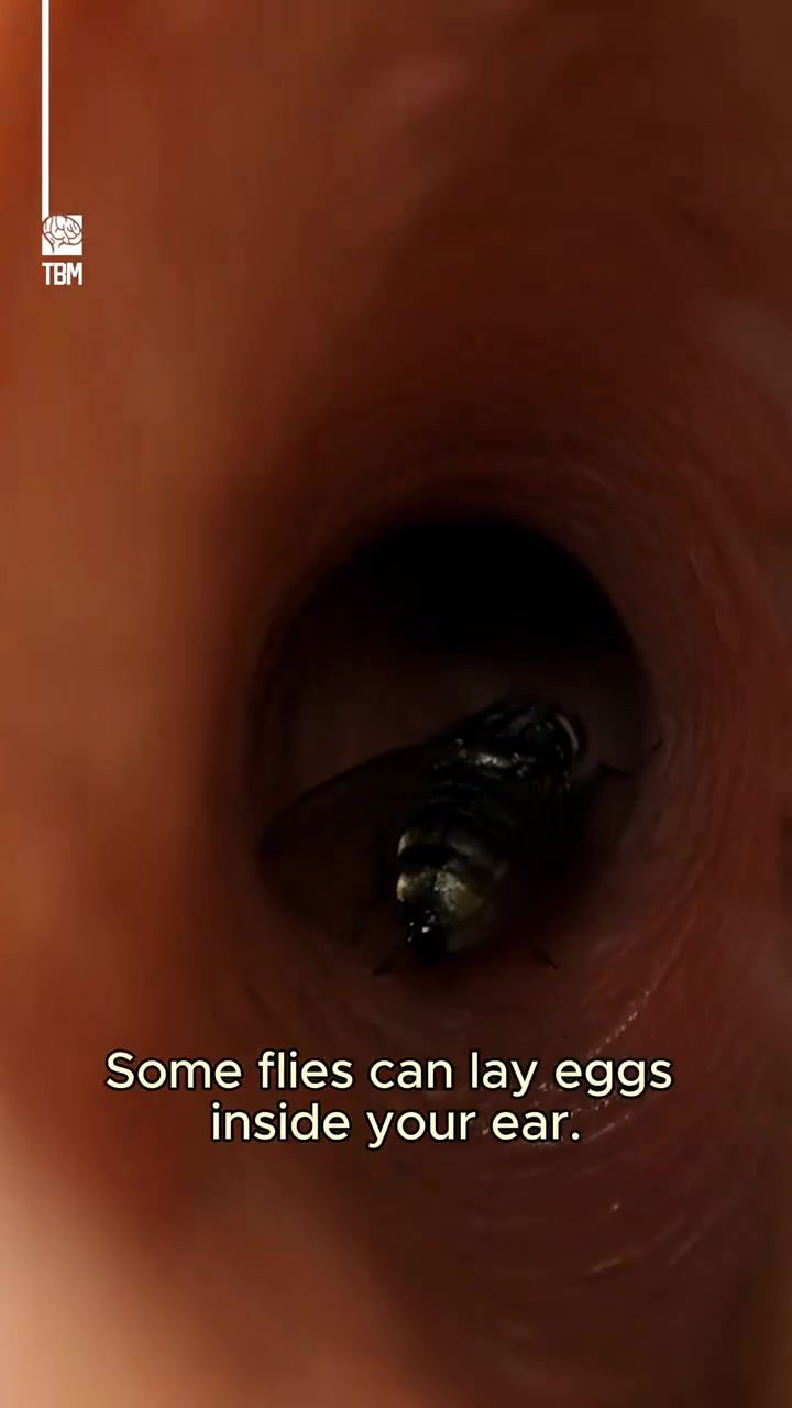 The Dangers of Fly Eggs in the Human Ear