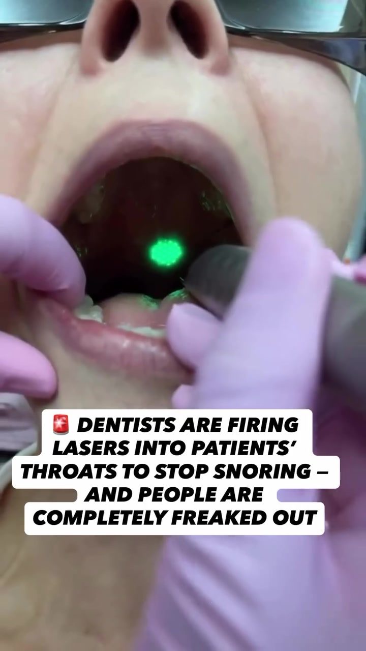Dentists Use Lasers to Stop Snoring: Public's Shocking Reaction