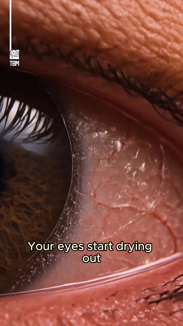 How Screen Time Can Cause Dry Eyes