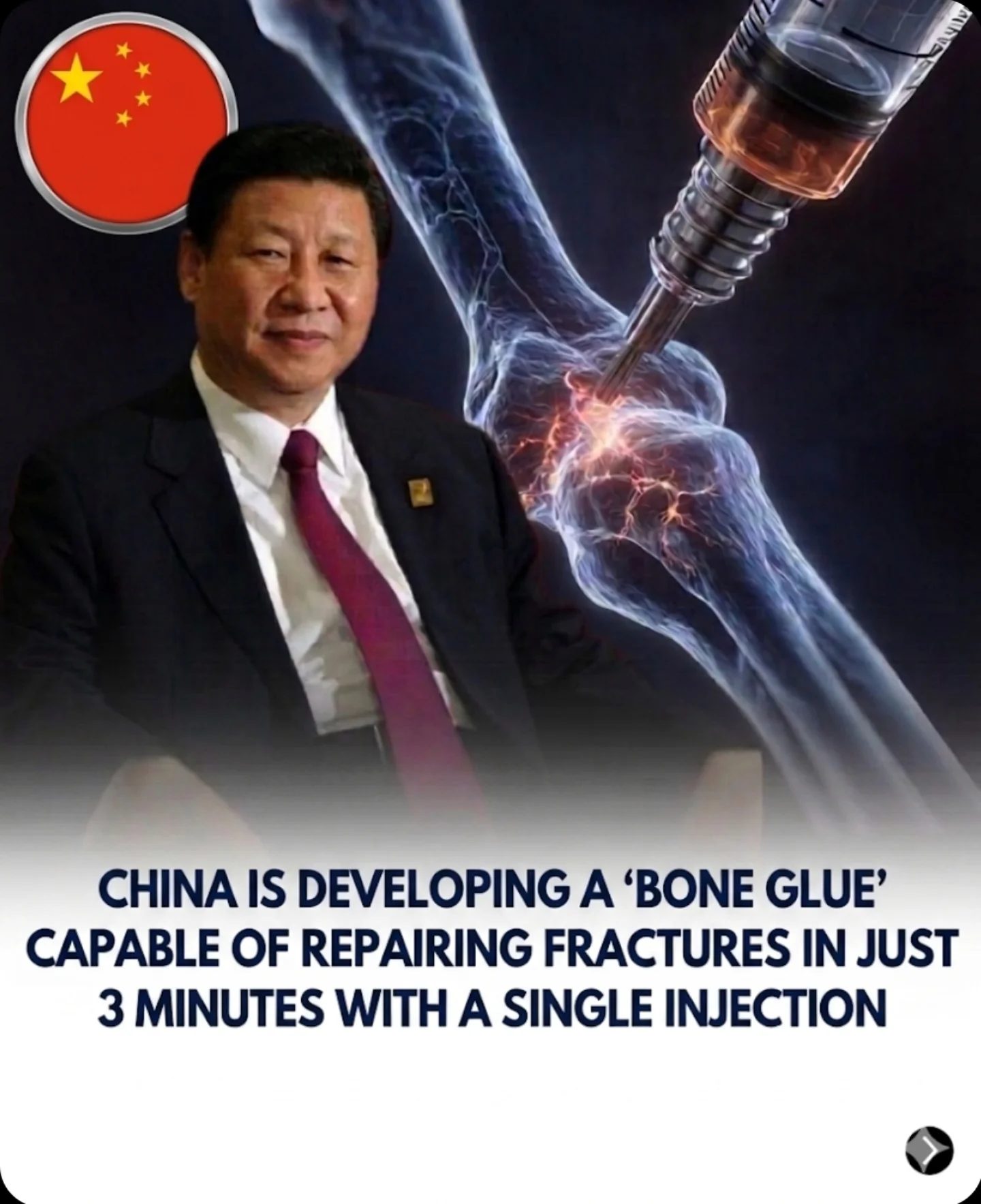 China's 'Bone Glue' Repairs Fractures in 3 Minutes