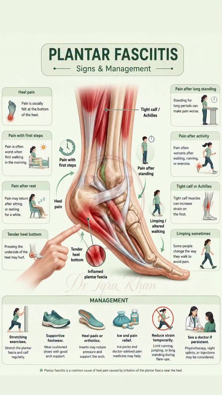 Understanding Plantar Fasciitis: Symptoms and Relief