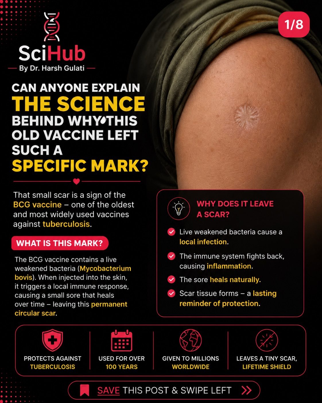 Unveiling the Science Behind the BCG Vaccine Scar