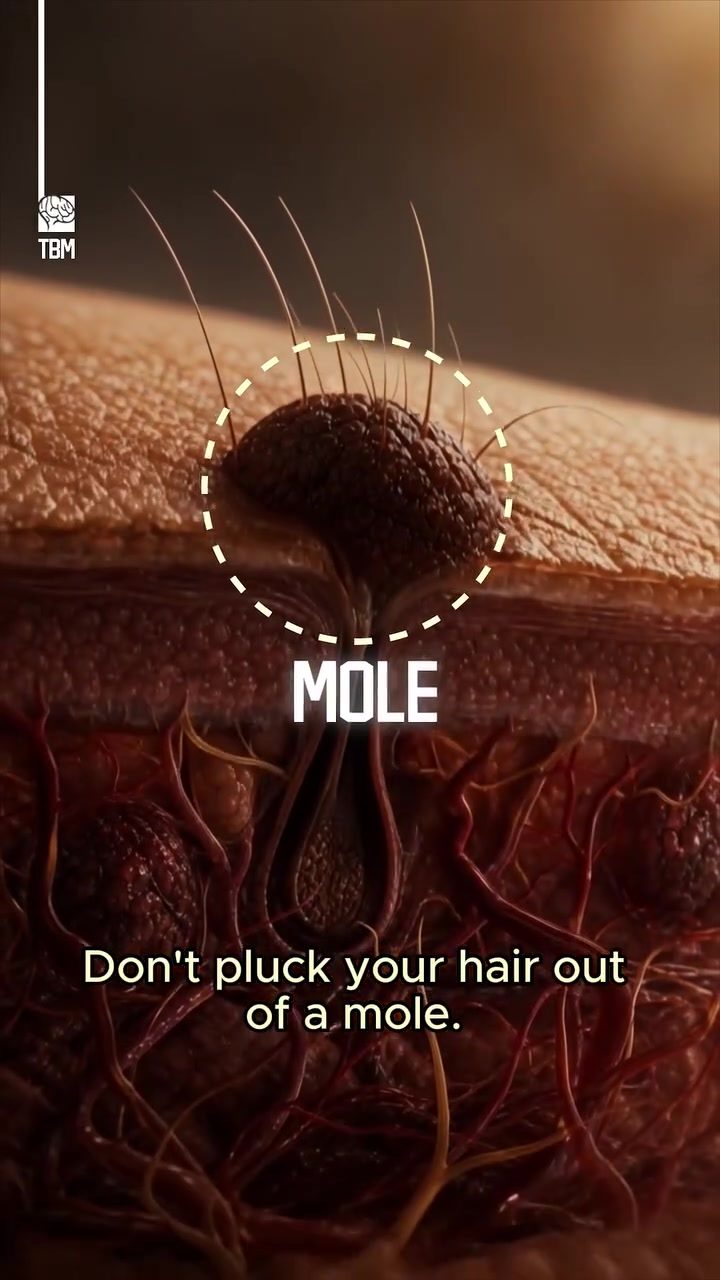 Why You Should Never Pluck Hair from a Mole