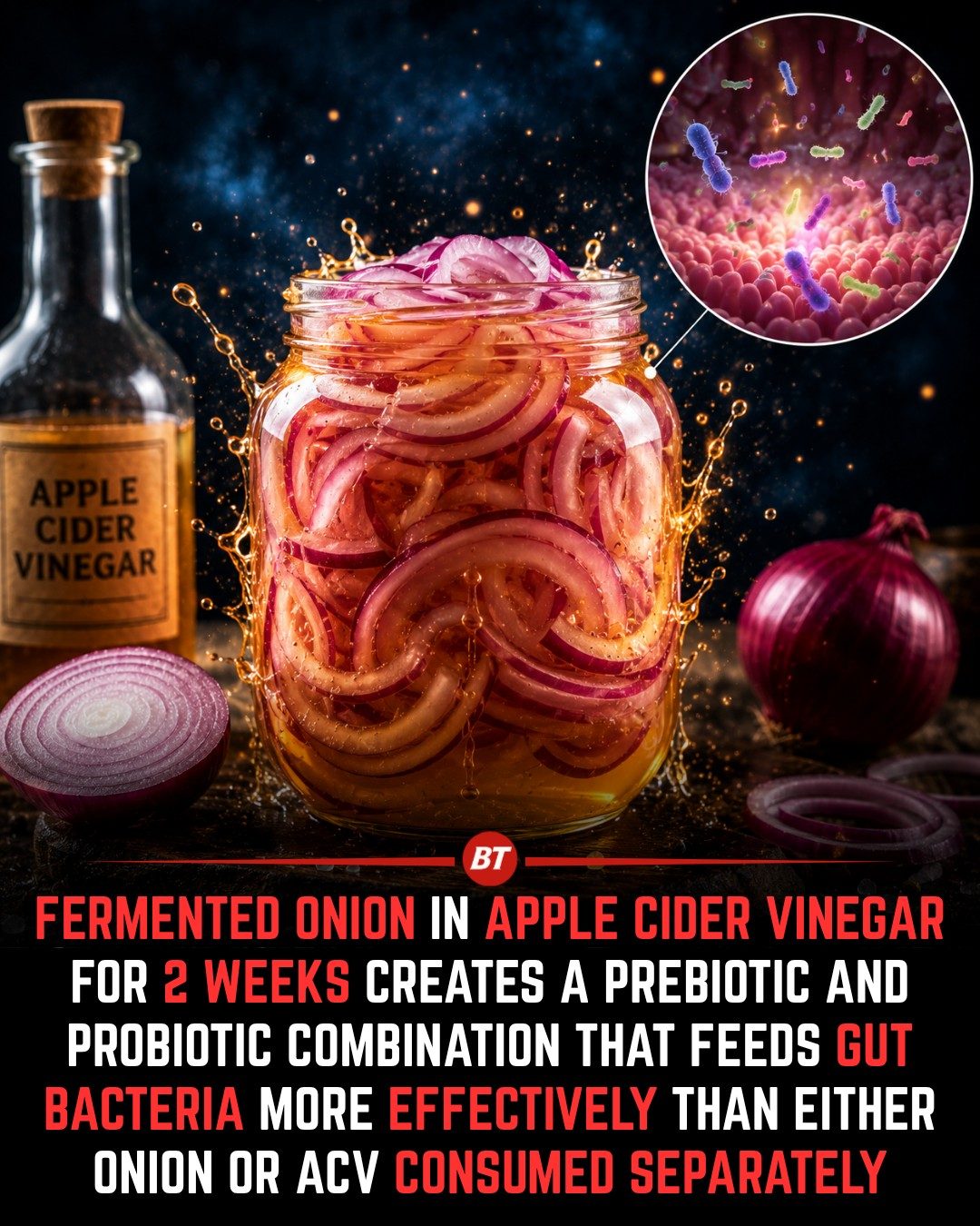 Fermented Onions: Gut Health Benefits & Apple Cider Vinegar