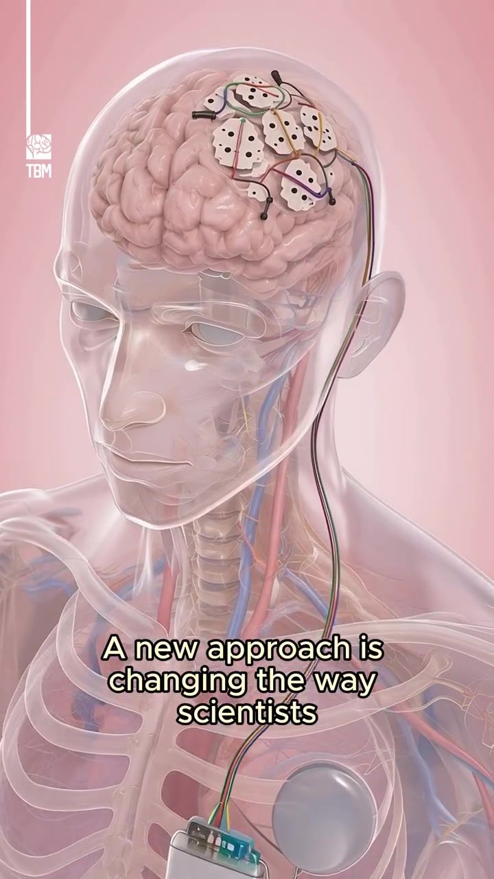 Revolutionizing Brain Tumor Treatment with Grace