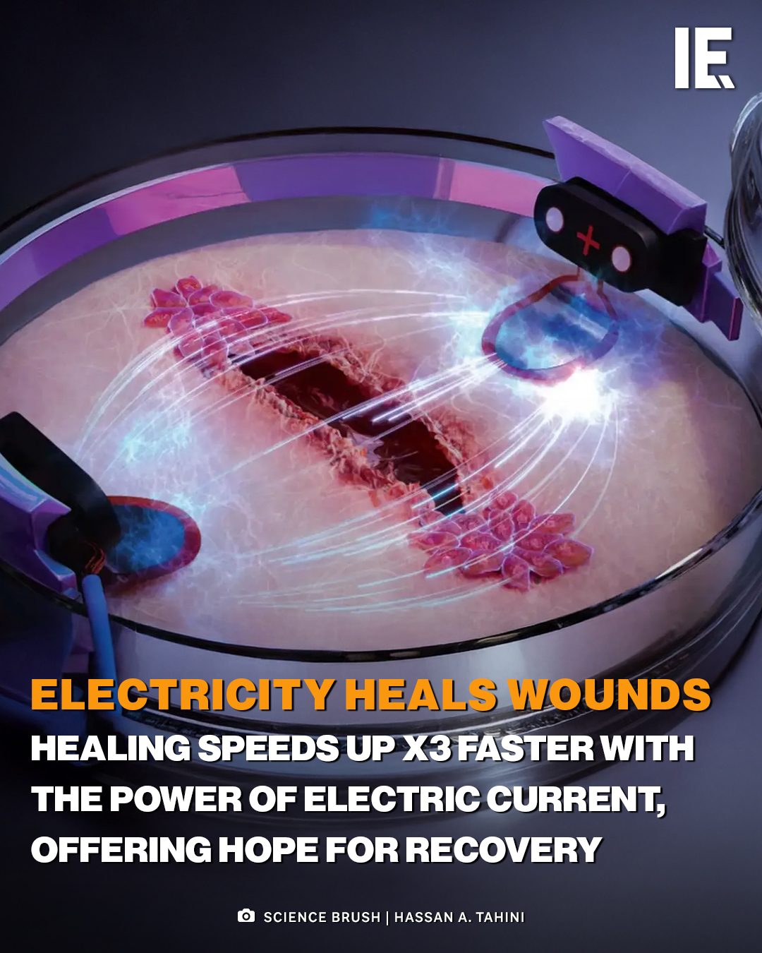 Electric Current's Role in Faster Wound Healing