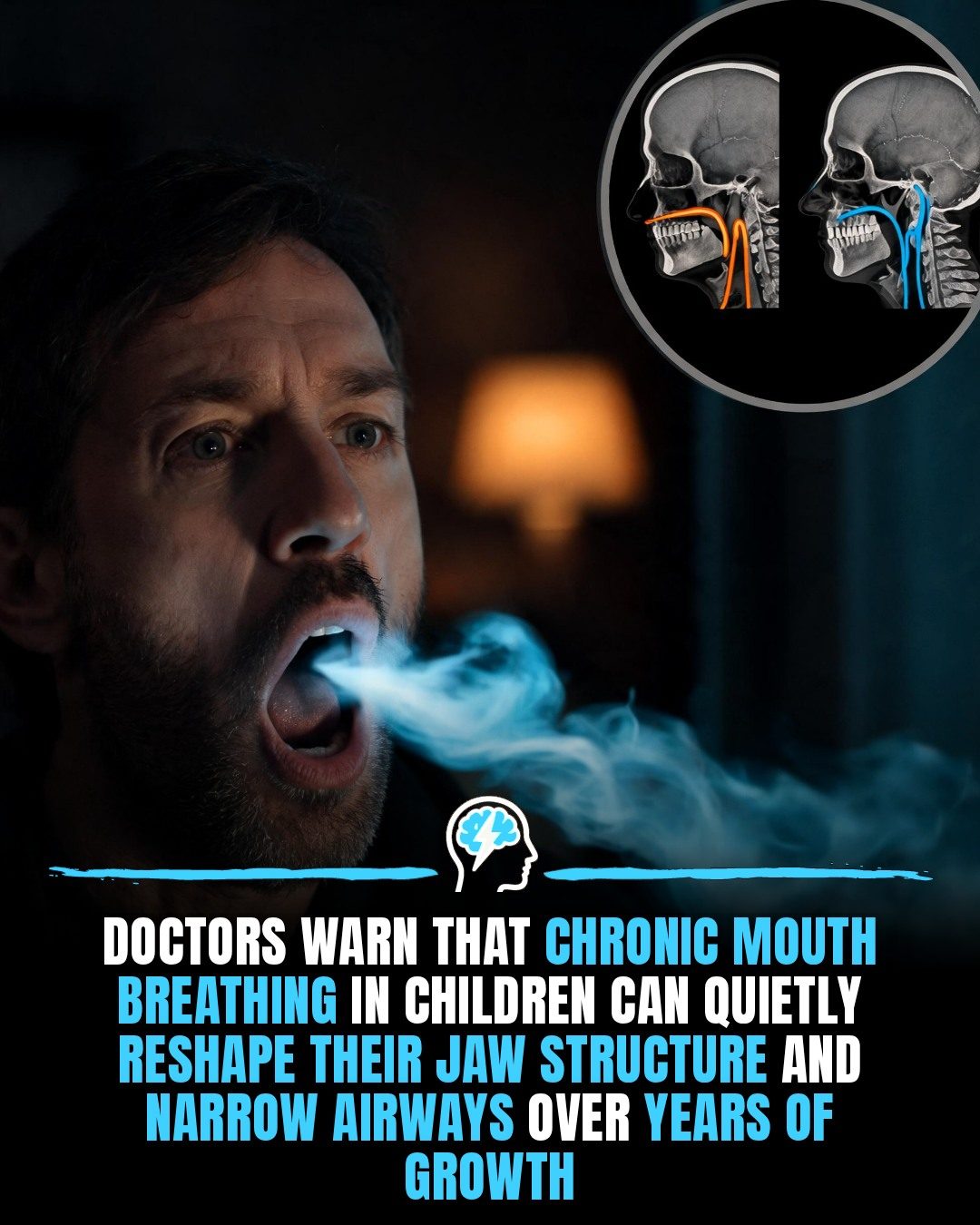 How Chronic Mouth Breathing Alters Children's Facial Structure & Airways