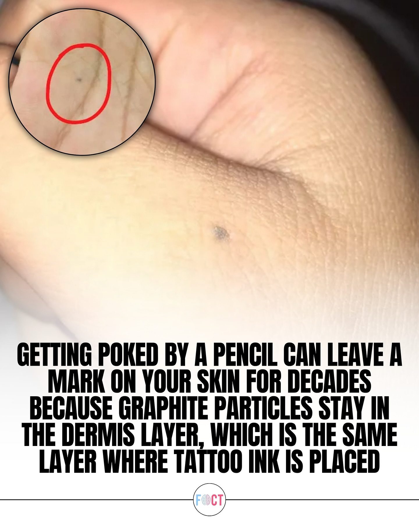 Pencil Poke Marks: Why They Can Last for Decades.