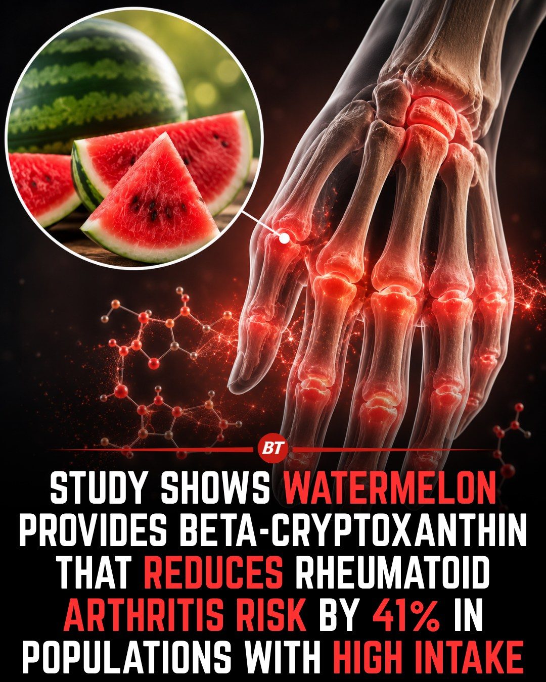 How Watermelon May Help Lower Arthritis Risk