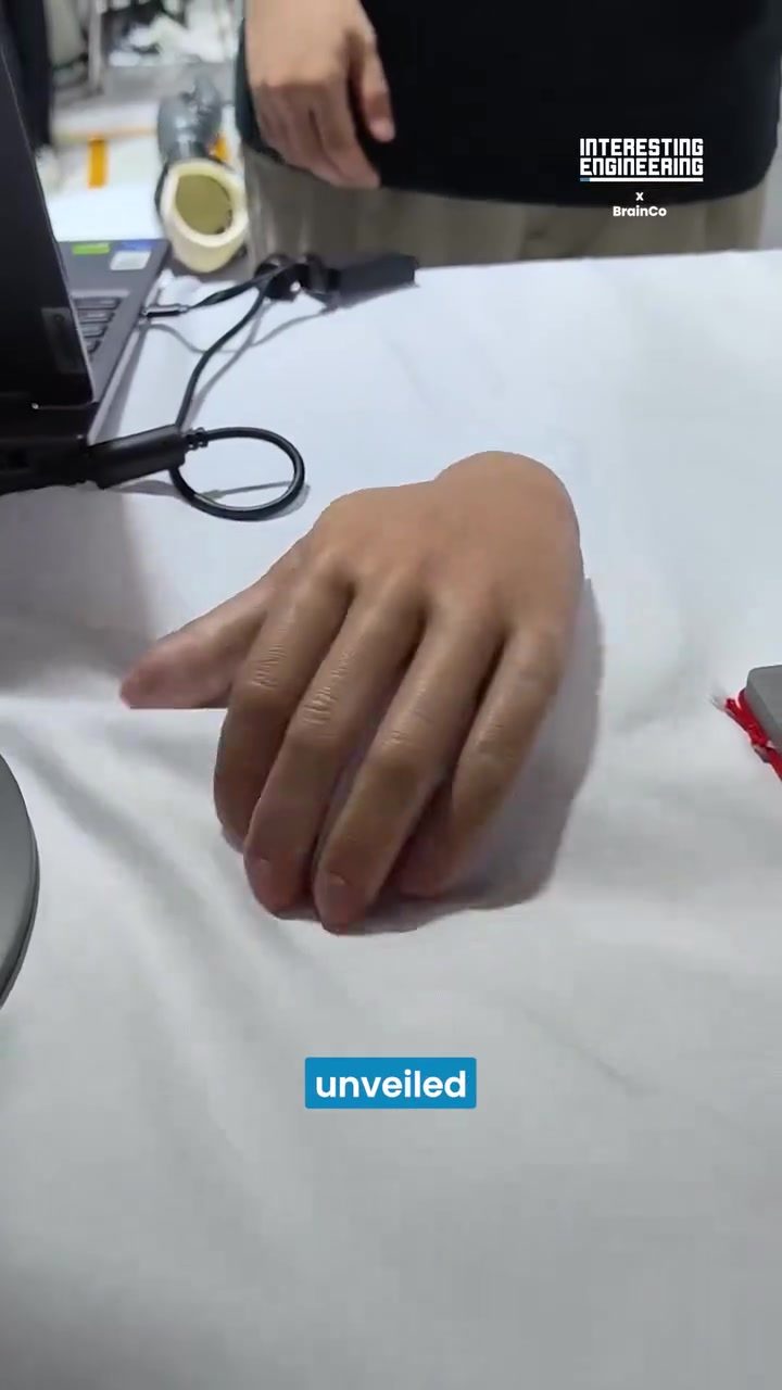 BrainCo's Wireless AI Bionic Hand for Natural Movements