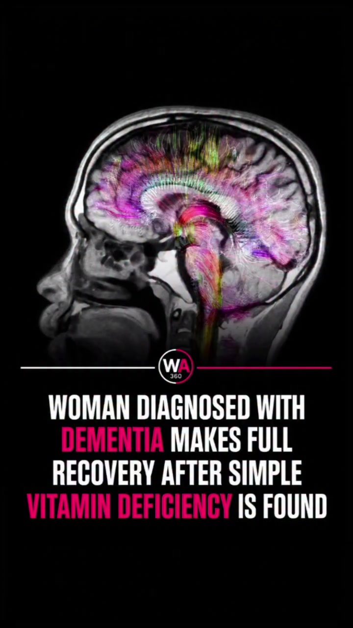 How Vitamin Deficiencies Can Mimic Dementia