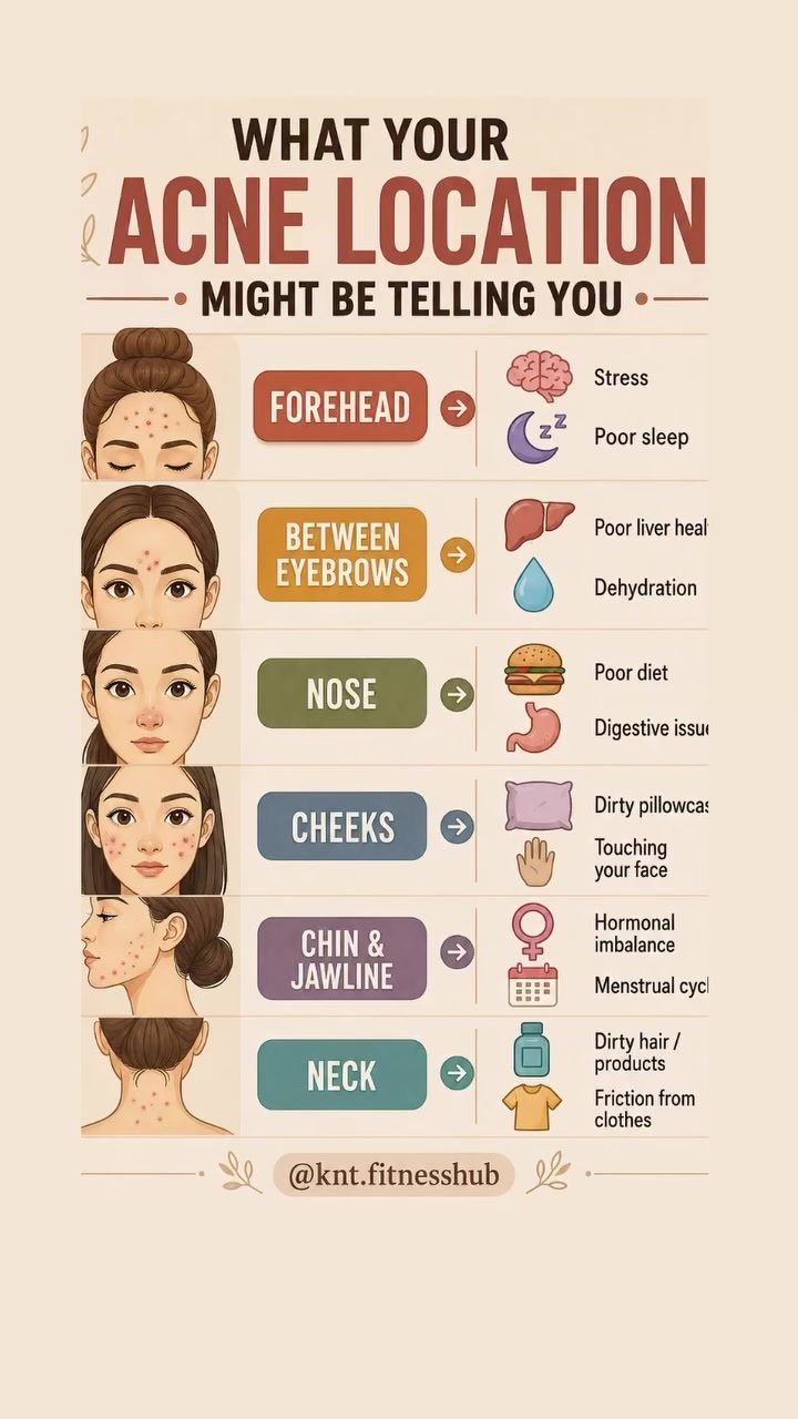 Acne Location: Uncovering Triggers for Clearer Skin