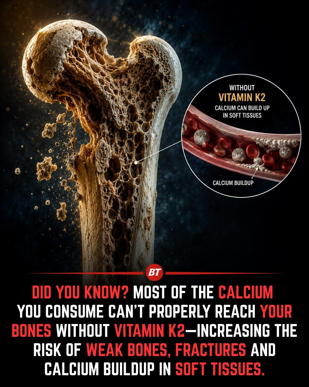 Vitamin K2: The Key to Optimal Calcium Absorption for Bone Health